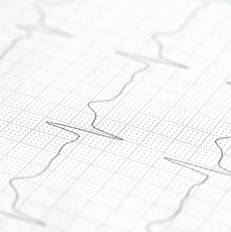 Patienteninfo: Offene Rhythmus-Sprechstunde