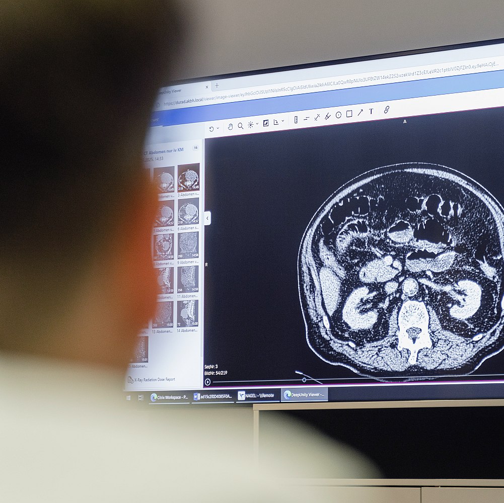 Krupp Onko Update 2026